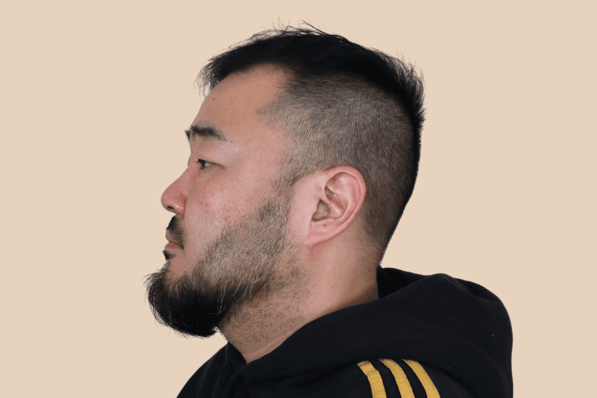 구레나룻 턱수염 라인을 또렷하게 디자인한 사례 애프터