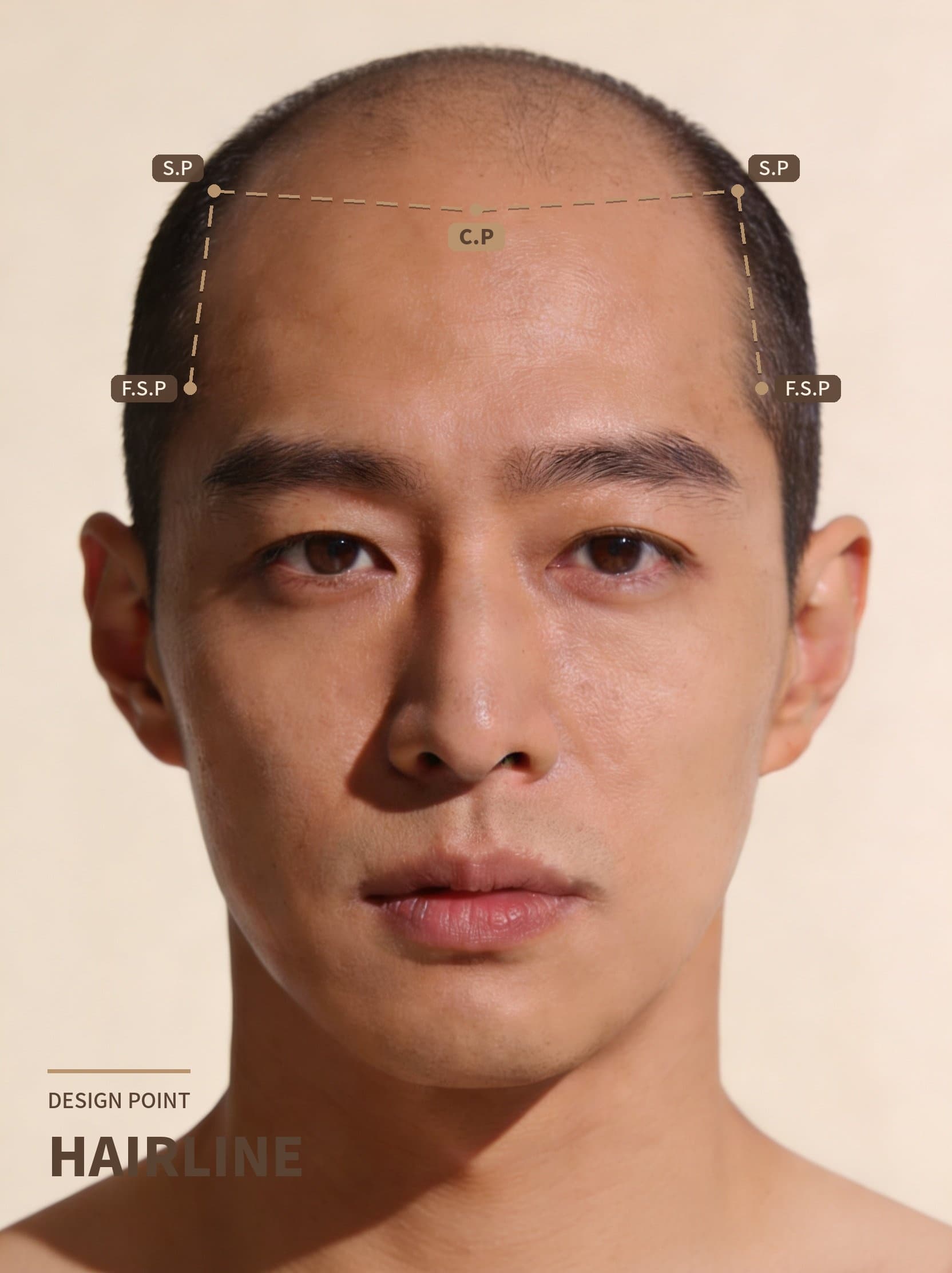 삭발 두피문신 헤어라인 디자인 - C.P S.P F.S.P 포인트