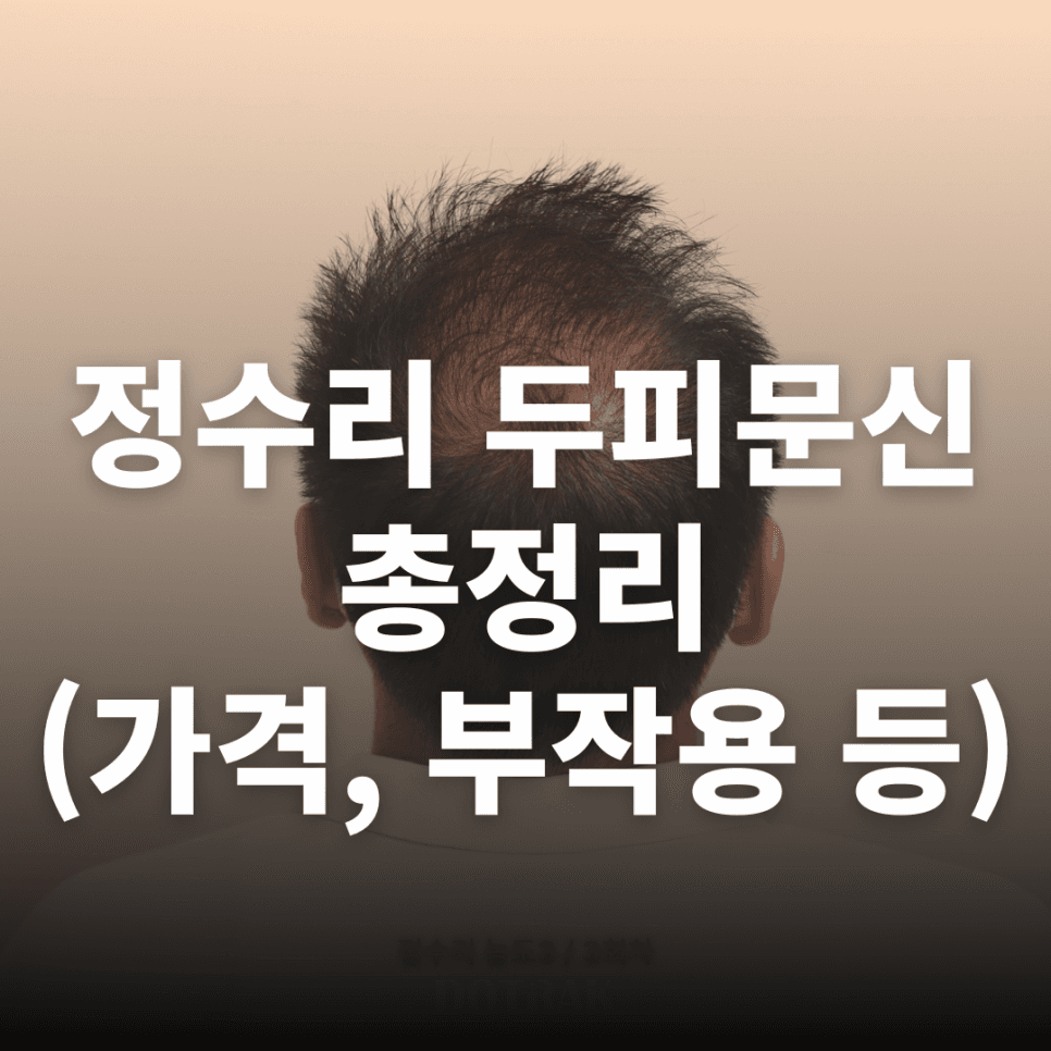정수리 두피문신 총정리 (가격, 부작용, 주의할 점)