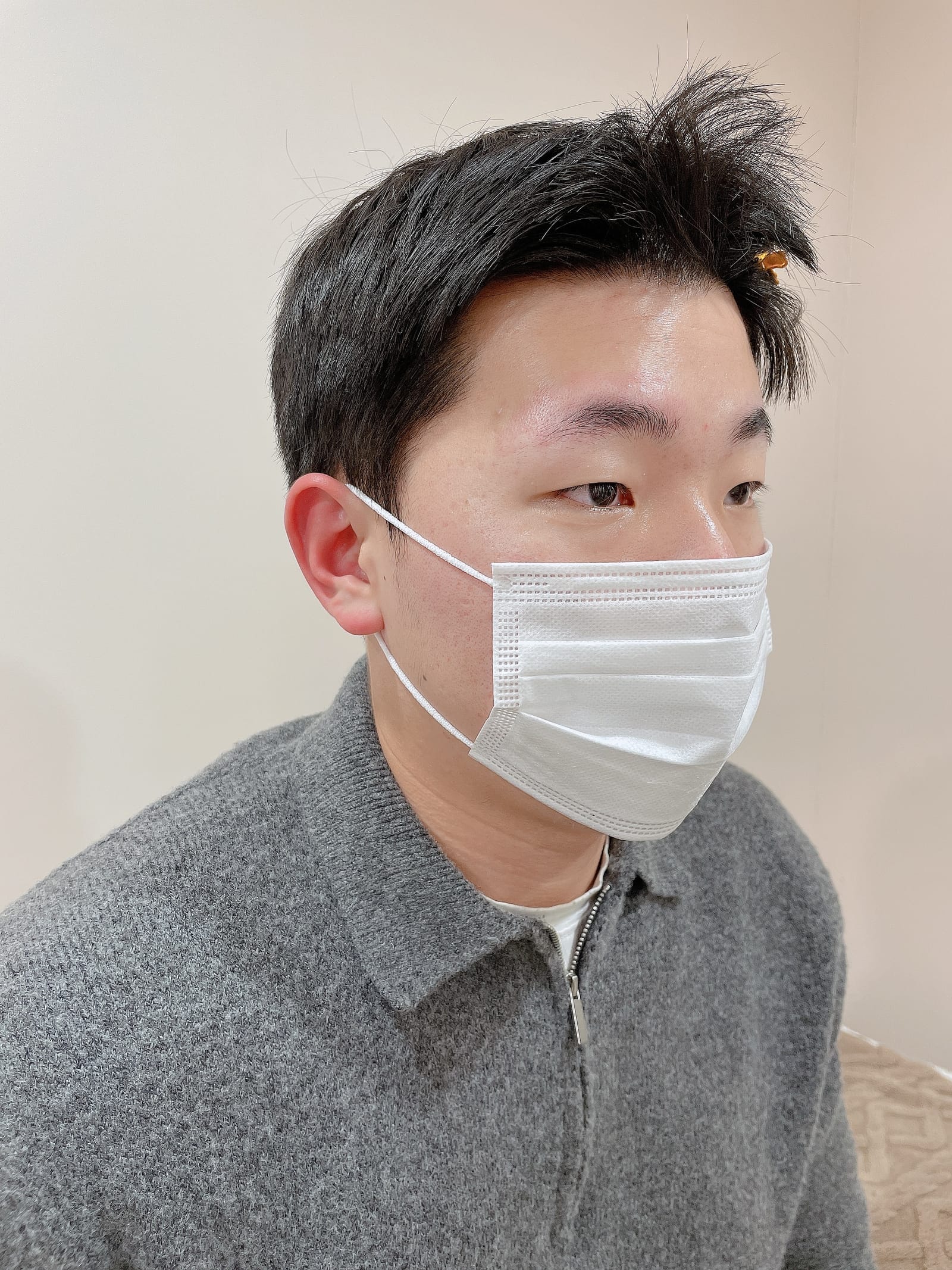 헤어스트록 비포