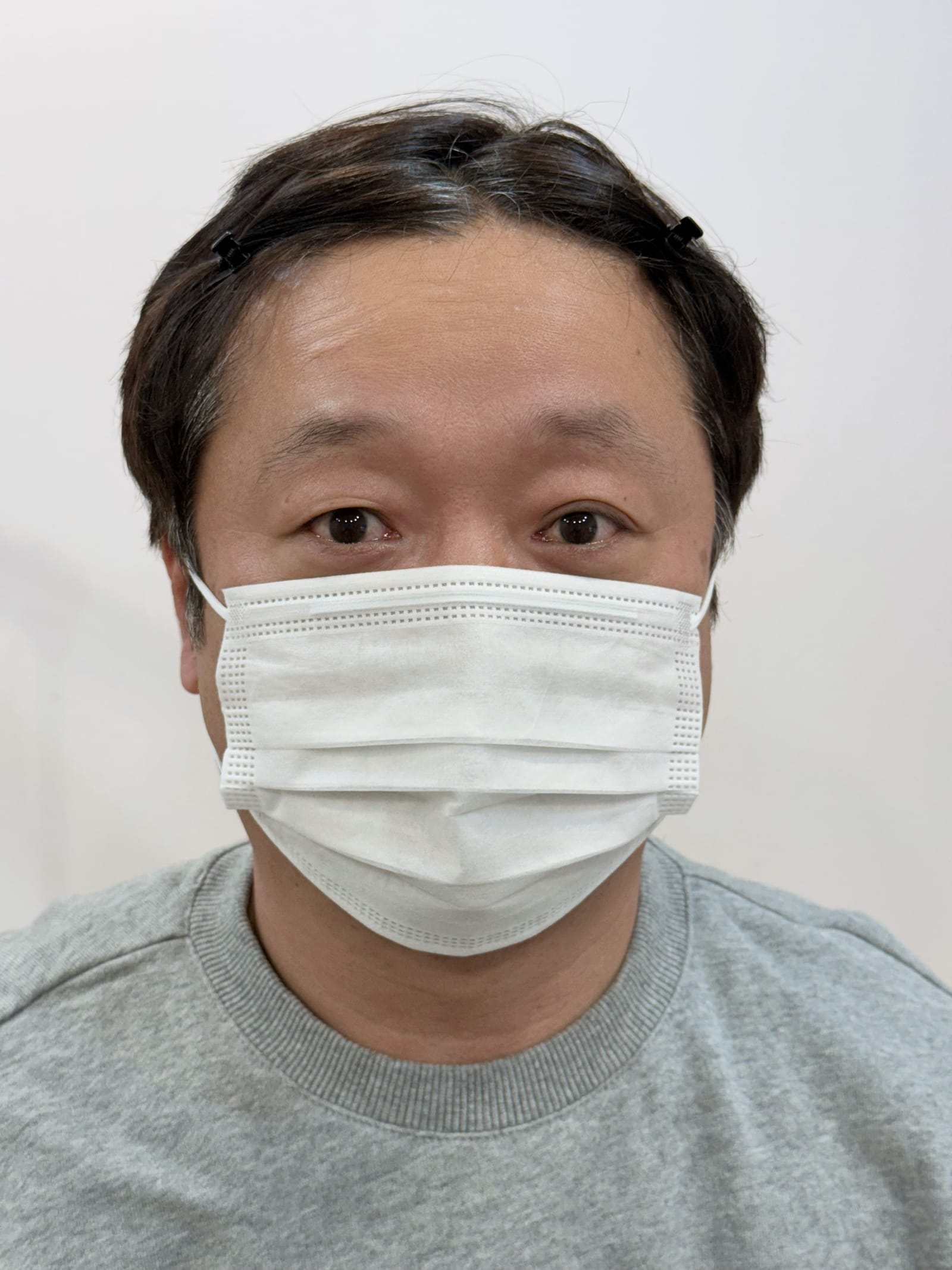 헤어스트록 비포