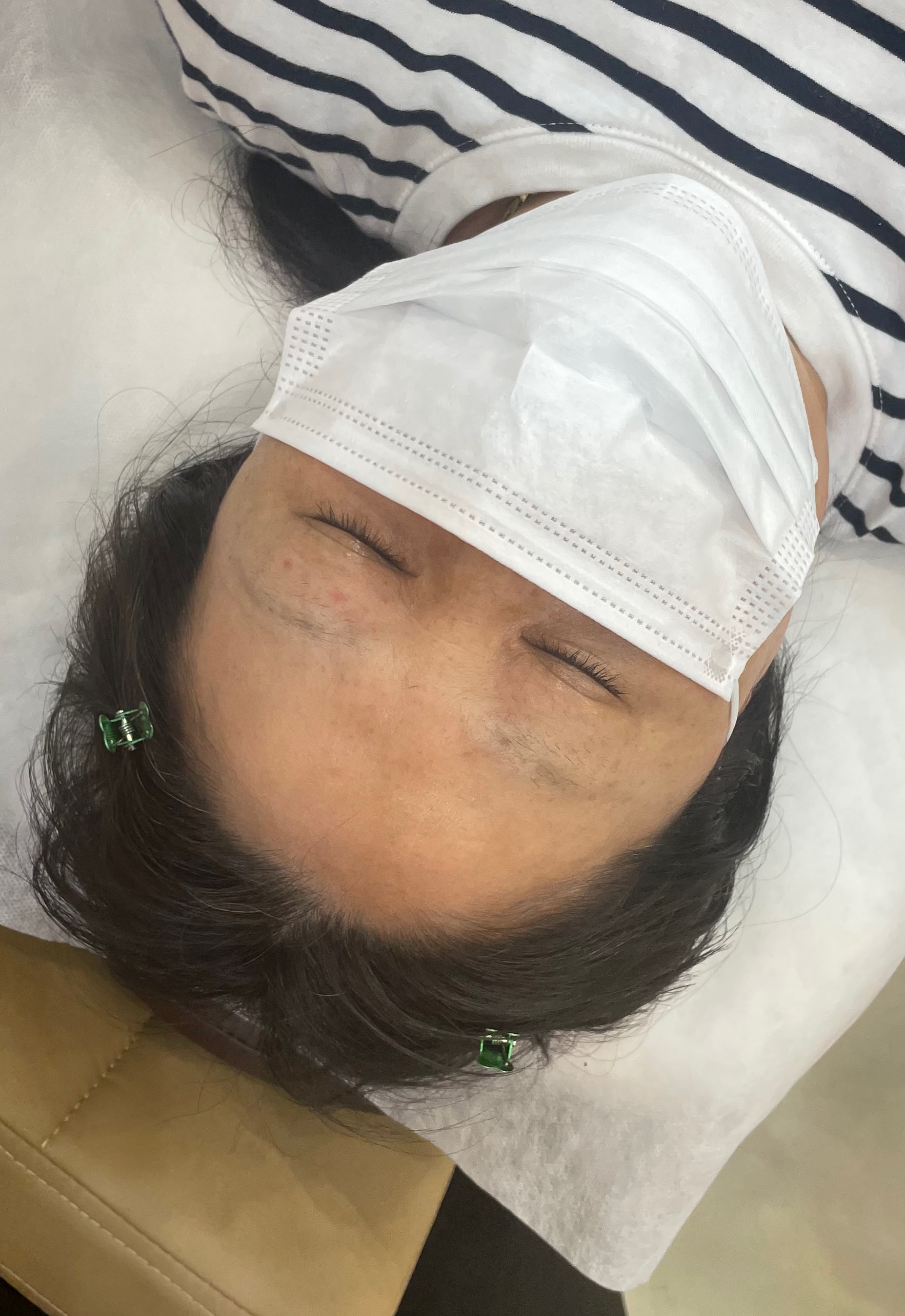 헤어스트록 비포