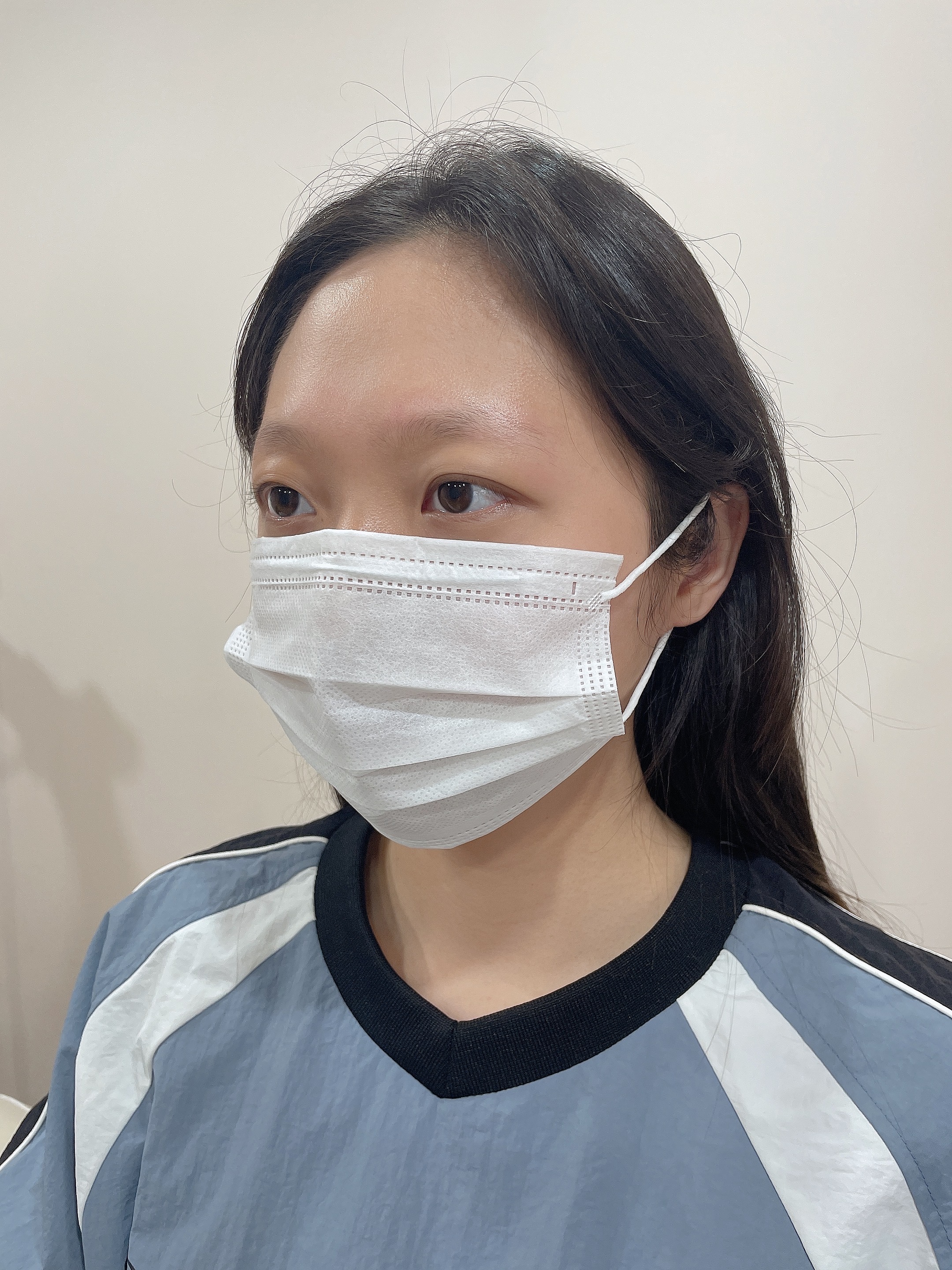 헤어스트록 비포