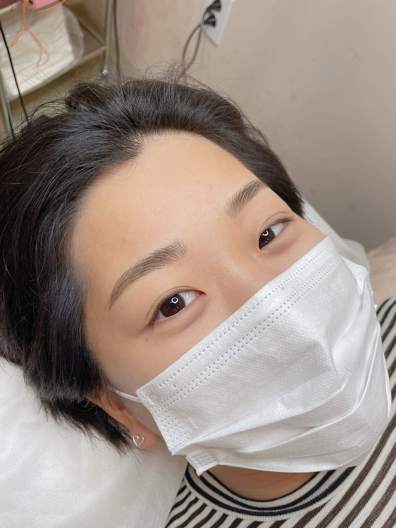 헤어스트록 애프터